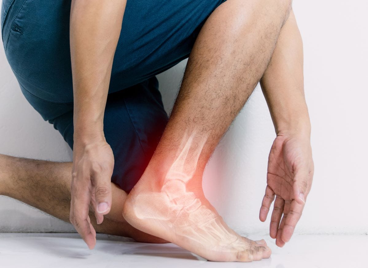 What Is an Average Slip and Fall Sprained Ankle Settlement?