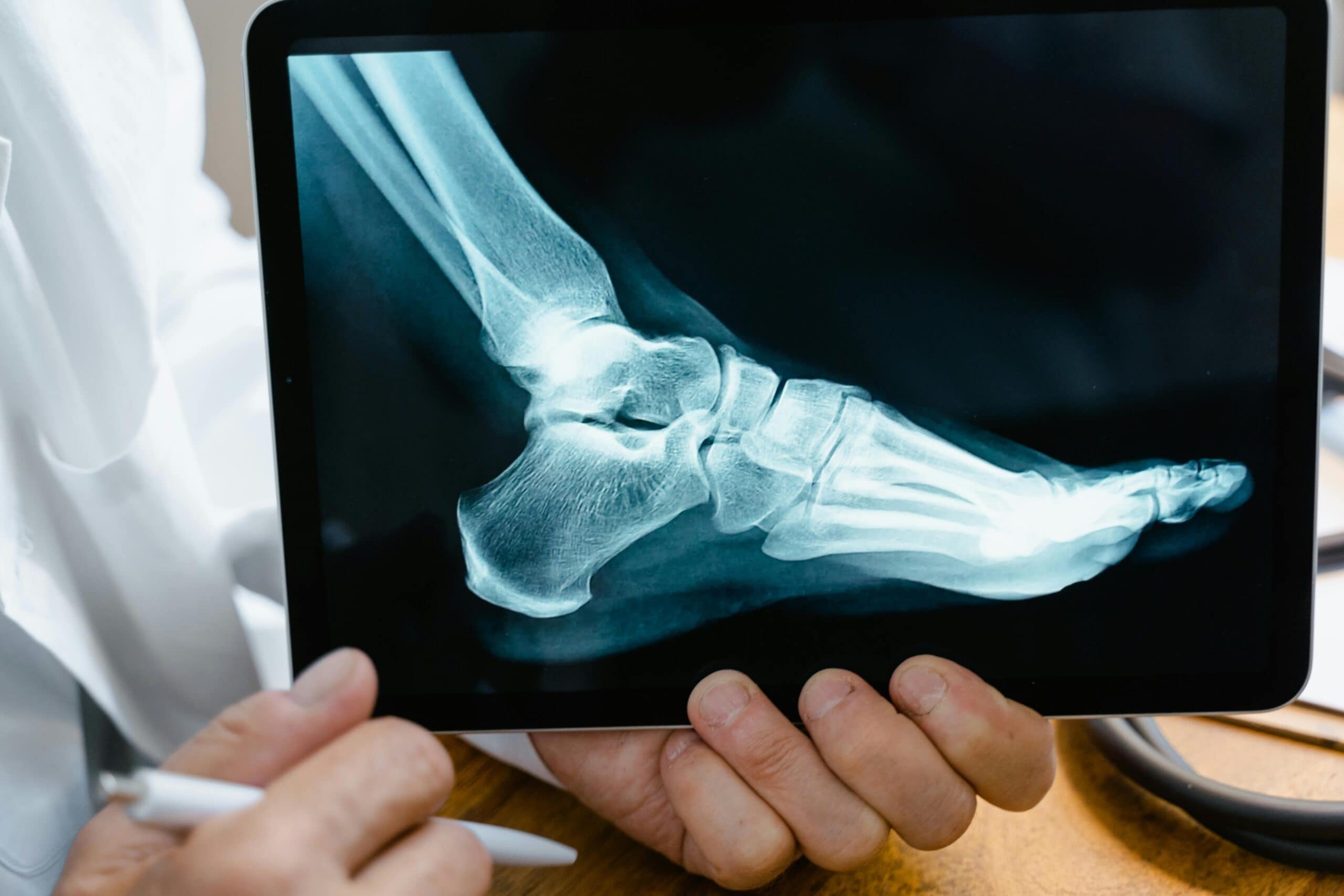 A foot scan indicating an injury that was highlighted in a premises liability lawsuit.